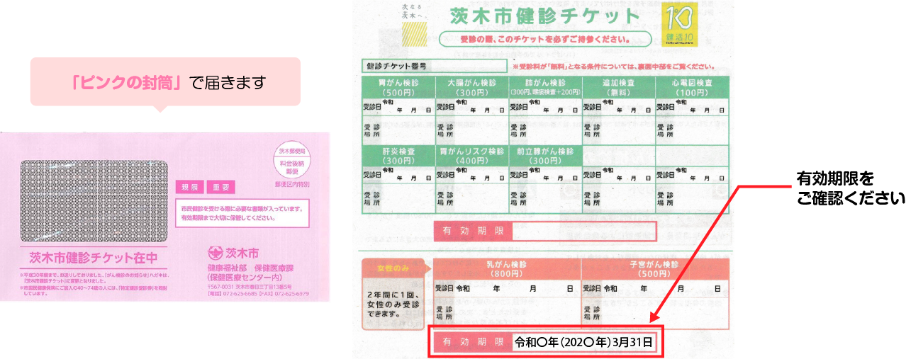 チェック