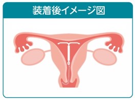 装着イメージ
